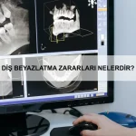 Erken boşalma neden olur ve nasıl önlenir?
