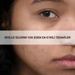 Diş beyazlatma zararları nelerdir?